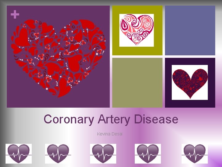 + Coronary Artery Disease Kevina Desai 