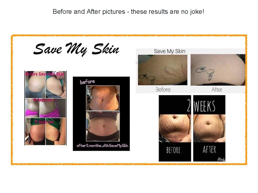 Before and After pictures - these results are no joke! 