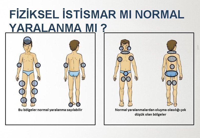 FİZİKSEL İSTİSMAR MI NORMAL YARALANMA MI ? 