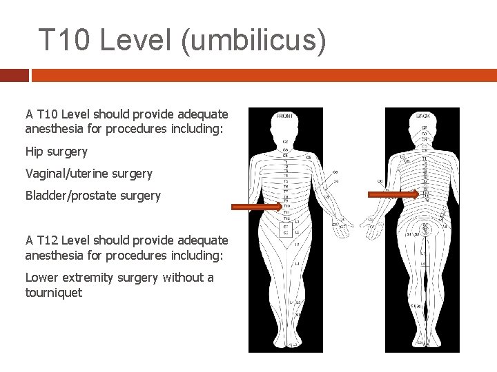 T 10 Level (umbilicus) A T 10 Level should provide adequate anesthesia for procedures