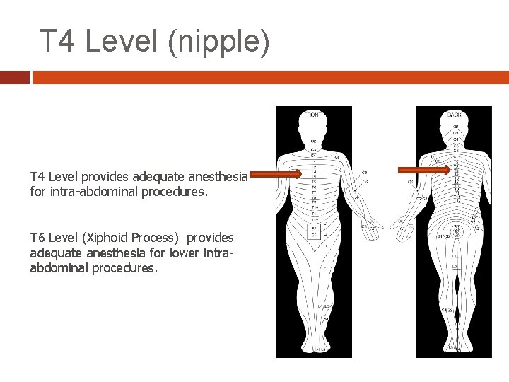 T 4 Level (nipple) T 4 Level provides adequate anesthesia for intra-abdominal procedures. T