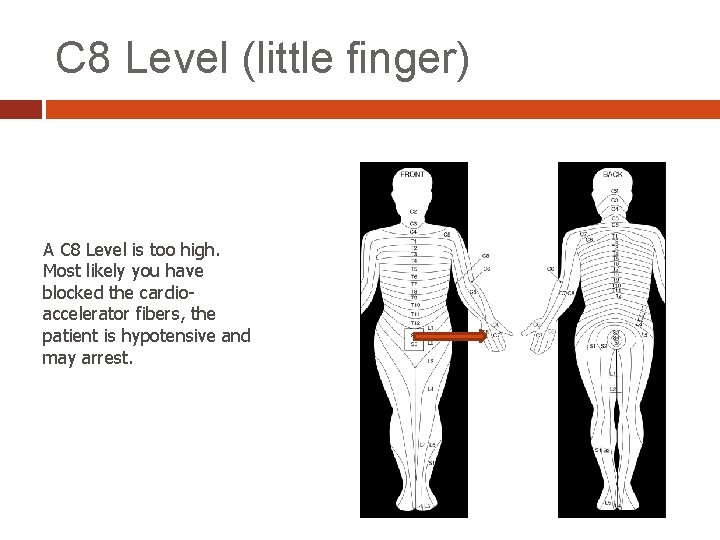 C 8 Level (little finger) A C 8 Level is too high. Most likely