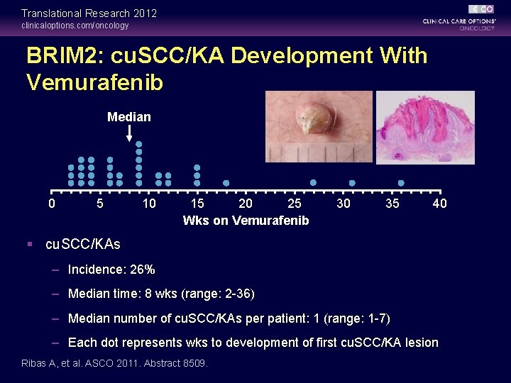 Translational Research 2012 clinicaloptions. com/oncology BRIM 2: cu. SCC/KA Development With Vemurafenib Median 0