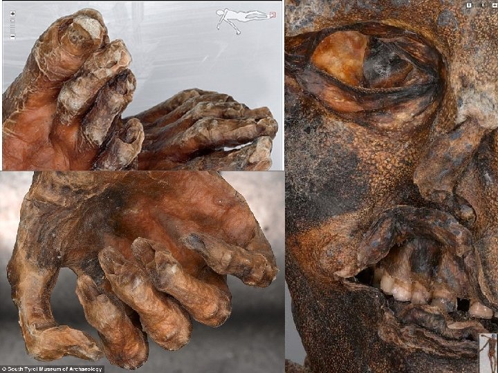 Ako Ötzi vyzeral § § Mal asi 40 rokov Tmavé vlasy Bol vysoký 160