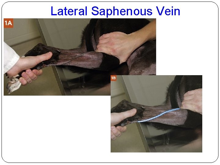 Lateral Saphenous Vein 