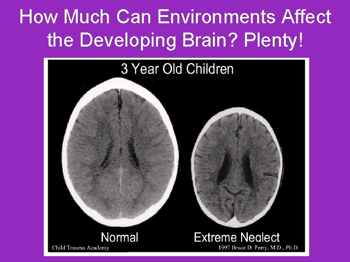 How Much Can Environments Affect the Developing Brain? Plenty! 