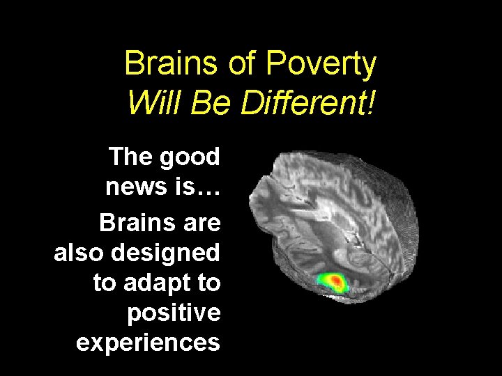 Brains of Poverty Will Be Different! The good news is… Brains are also designed