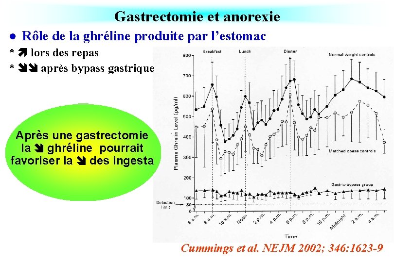 Gastrectomie et anorexie l Rôle de la ghréline produite par l’estomac * lors des