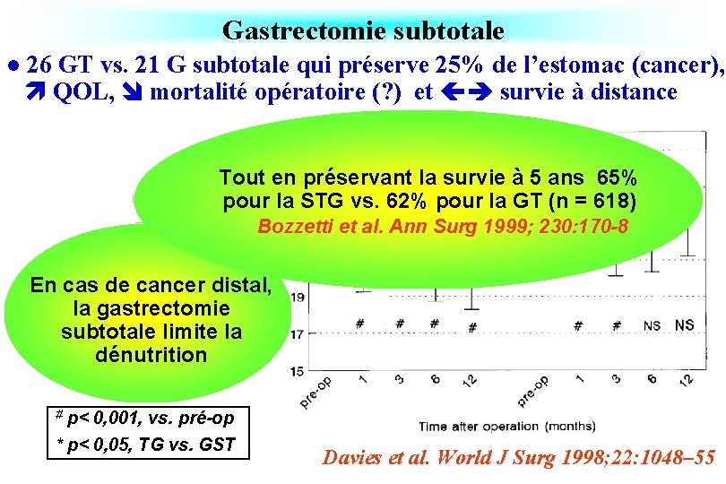 Gastrectomie subtotale l 26 GT vs. 21 G subtotale qui préserve 25% de l’estomac