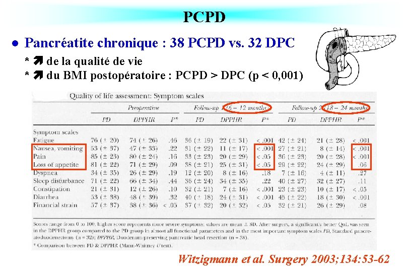 PCPD l Pancréatite chronique : 38 PCPD vs. 32 DPC * de la qualité