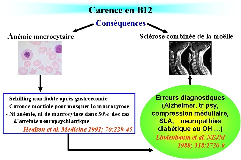 Carence en B 12 Conséquences Anémie macrocytaire - Schilling non fiable après gastrectomie -