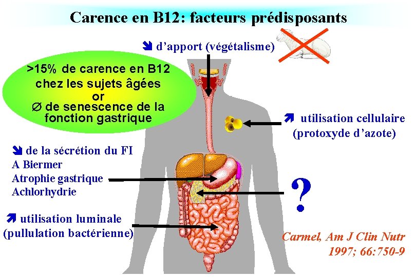Carence en B 12: facteurs prédisposants d’apport (végétalisme) >15% de carence en B 12