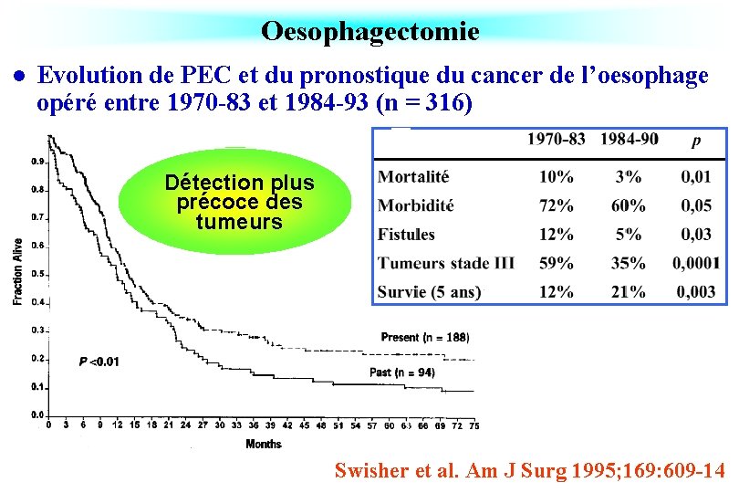 Oesophagectomie l Evolution de PEC et du pronostique du cancer de l’oesophage opéré entre