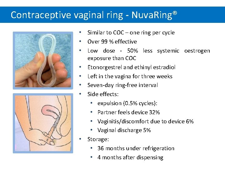 Contraceptive vaginal ring - Nuva. Ring® • Similar to COC – one ring per