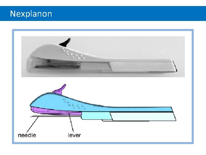 Nexplanon 