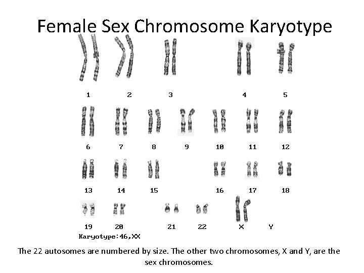Female Sex Chromosome Karyotype The 22 autosomes are numbered by size. The other two