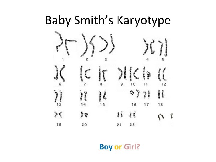 Baby Smith’s Karyotype Boy or Girl? 