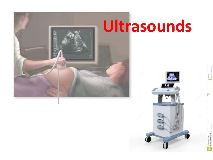 Ultrasounds 