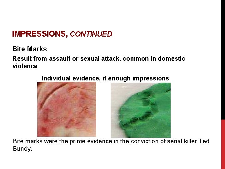 IMPRESSIONS, CONTINUED Bite Marks Result from assault or sexual attack, common in domestic violence