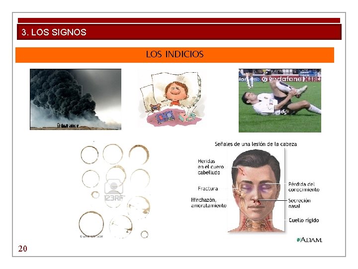 3. LOS SIGNOS LOS INDICIOS 20 3. LOS SIGNOS LOS INDICIOS 20