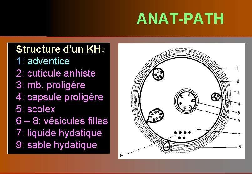 ANAT-PATH Structure d'un KH: 1: adventice 2: cuticule anhiste 3: mb. proligère 4: capsule