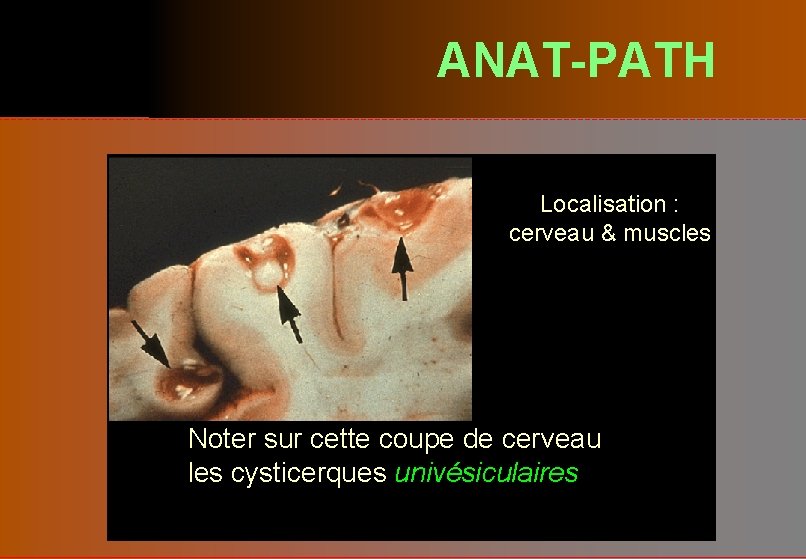 ANAT-PATH Localisation : cerveau & muscles Noter sur cette coupe de cerveau les cysticerques