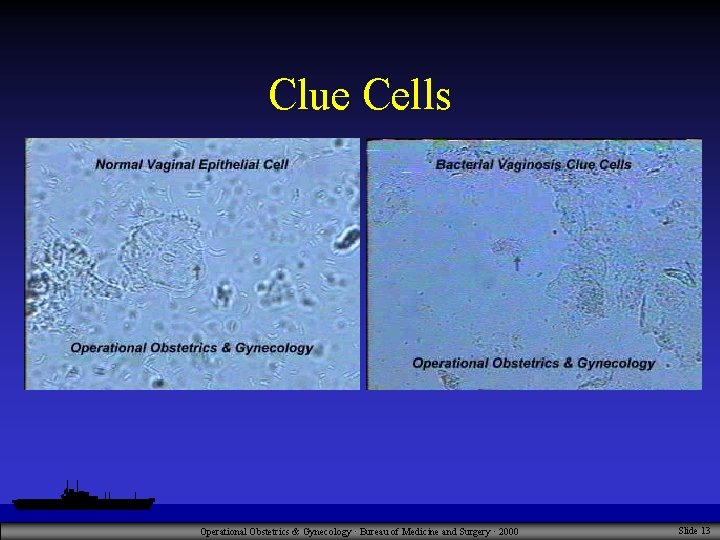 Clue Cells Operational Obstetrics & Gynecology · Bureau of Medicine and Surgery · 2000