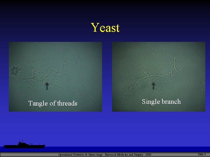 Yeast Tangle of threads Single branch Operational Obstetrics & Gynecology · Bureau of Medicine
