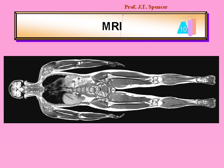 Prof. J. T. Spencer MRI 10 