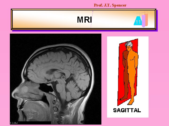 Prof. J. T. Spencer MRI 11 