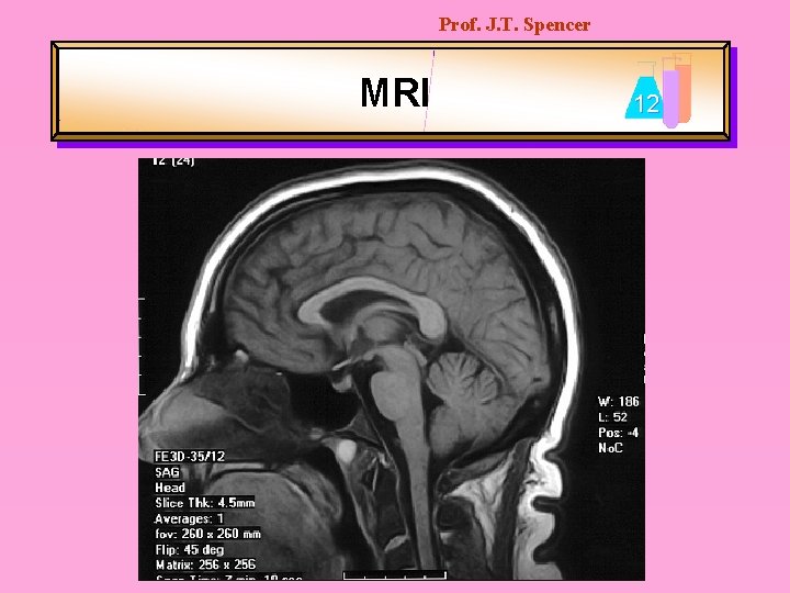 Prof. J. T. Spencer MRI 12 