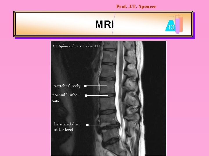 Prof. J. T. Spencer MRI 13 