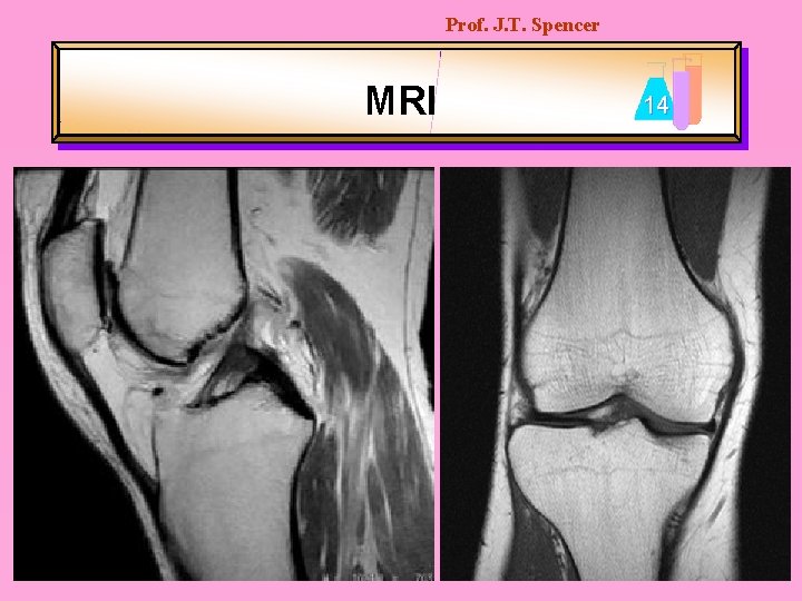 Prof. J. T. Spencer MRI 14 