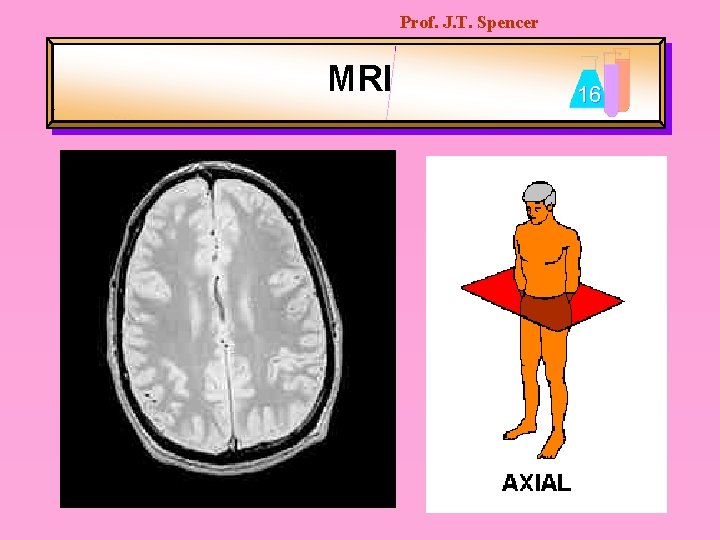 Prof. J. T. Spencer MRI 16 