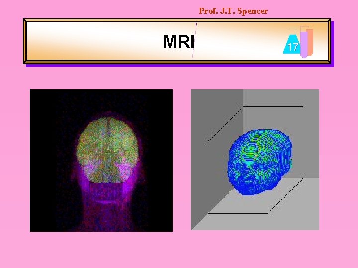 Prof. J. T. Spencer MRI 17 