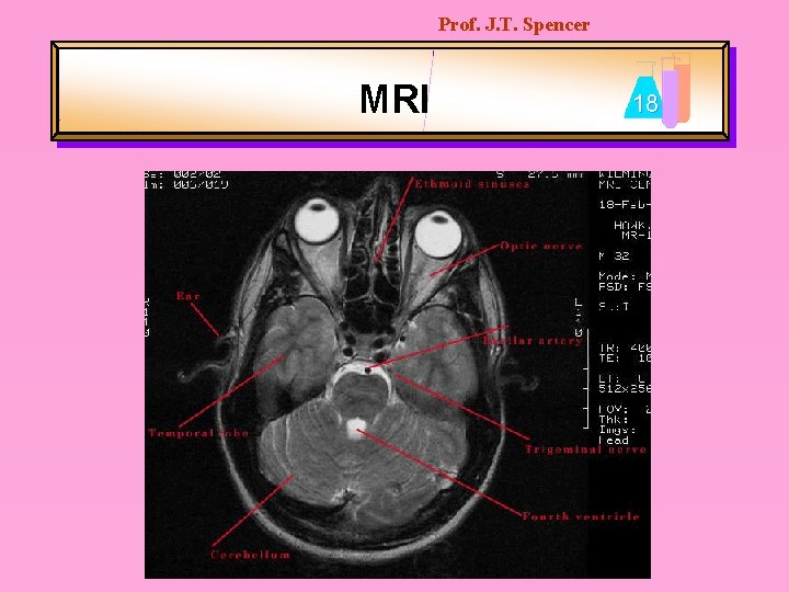 Prof. J. T. Spencer MRI 18 