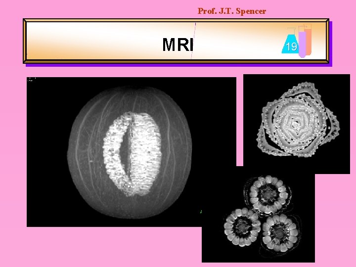 Prof. J. T. Spencer MRI 19 
