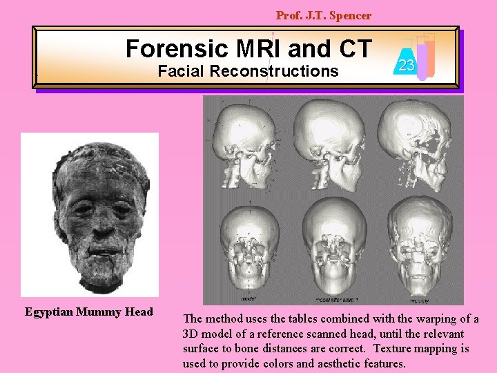Prof. J. T. Spencer Forensic MRI and CT Facial Reconstructions Egyptian Mummy Head 23