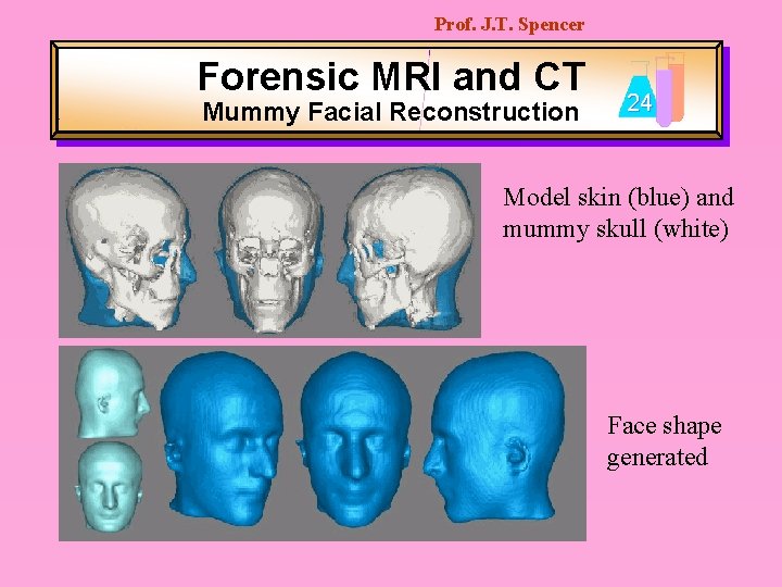 Prof. J. T. Spencer Forensic MRI and CT Mummy Facial Reconstruction 24 Model skin
