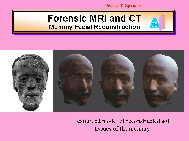 Prof. J. T. Spencer Forensic MRI and CT Mummy Facial Reconstruction 25 Texturized model