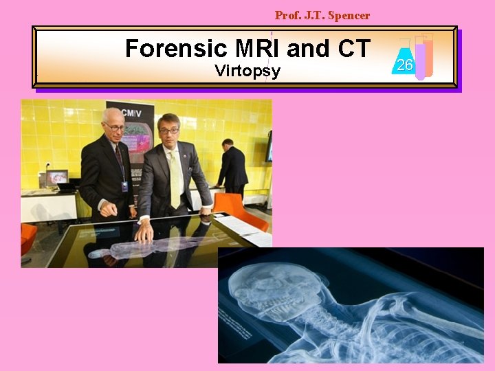 Prof. J. T. Spencer Forensic MRI and CT Virtopsy 26 