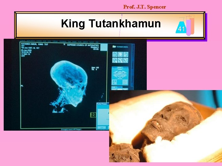 Prof. J. T. Spencer King Tutankhamun 41 