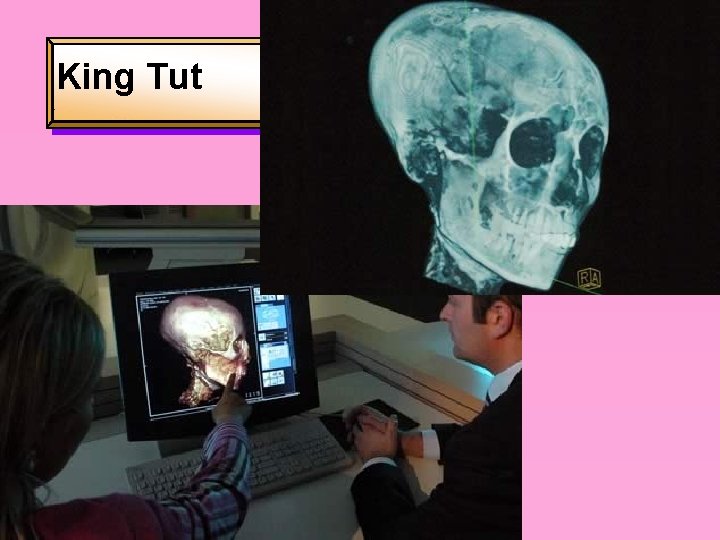 Prof. J. T. Spencer King Tut 42 
