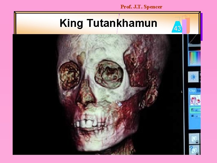 Prof. J. T. Spencer King Tutankhamun 43 