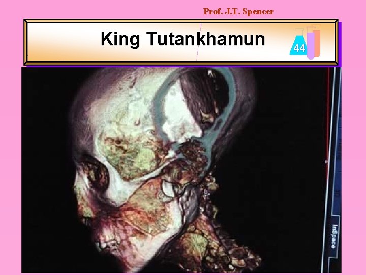 Prof. J. T. Spencer King Tutankhamun 44 