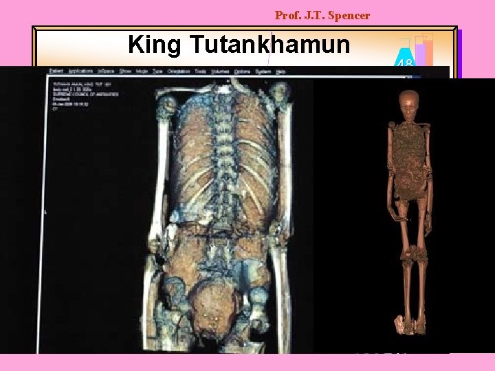 Prof. J. T. Spencer King Tutankhamun 48 