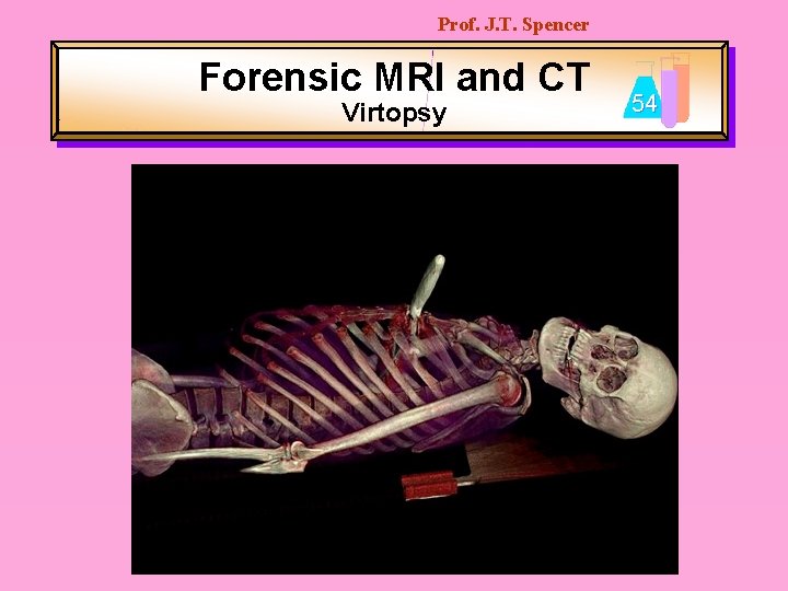 Prof. J. T. Spencer Forensic MRI and CT Virtopsy 54 