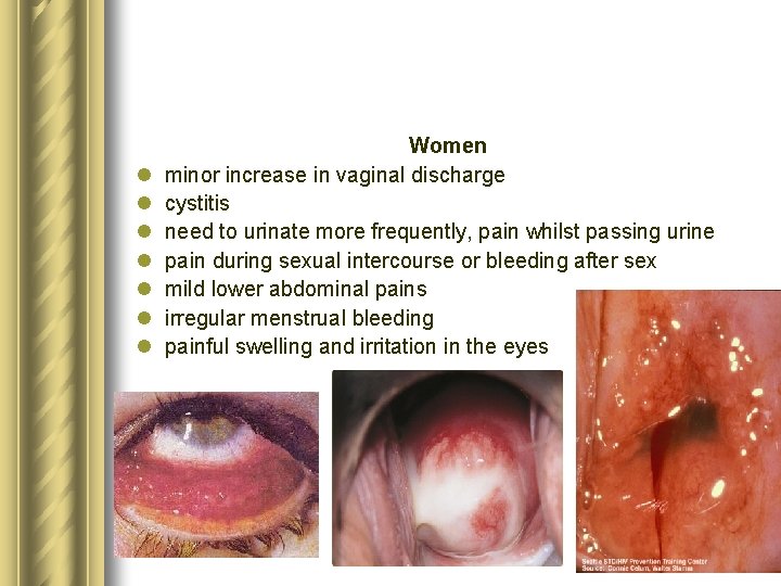 l l l l Women minor increase in vaginal discharge cystitis need to urinate l l l l Women minor increase in vaginal discharge cystitis need to urinate