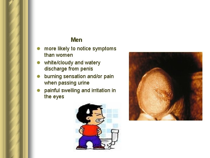 Tulo Sexually transmitted diseases chlamydia gonorrhea Mirela Grdovi Mentor