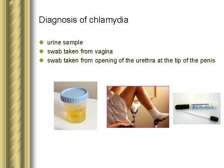 Diagnosis of chlamydia l urine sample l swab taken from vagina l swab taken Diagnosis of chlamydia l urine sample l swab taken from vagina l swab taken